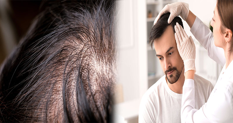 How to Identify Vitamin Deficiencies that Cause Thinning Hair and Hair Loss