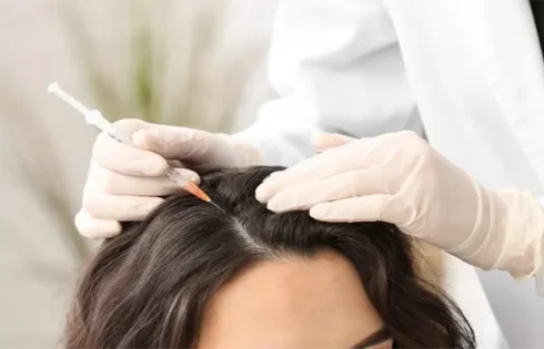 Understanding PRP Hair Treatment in London: Your Guide to Hair Loss Solutions