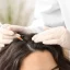 Understanding PRP Hair Treatment in London: Your Guide to Hair Loss Solutions