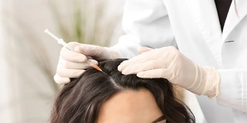 Understanding PRP Hair Treatment in London: Your Guide to Hair Loss Solutions